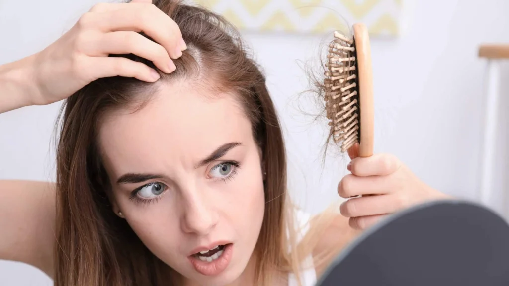 ریزش مو بر تاثییر استرس دلایل، تشدید کننده‌ها، درمان‌ها اسکوار.webp