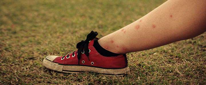 از بین بردن ساس | این حشره از چه چیزی بدش می آید_اسکوار 14 ساس - علائم گزش ساس